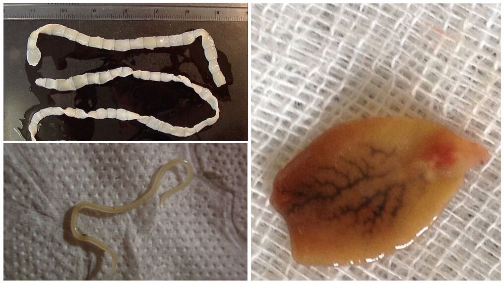 Τύποι παρασίτων