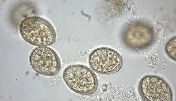 Παράσιτα στο μικροσκόπιο